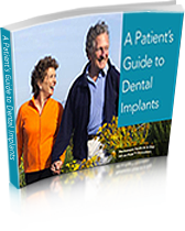 Free dental implants e-book